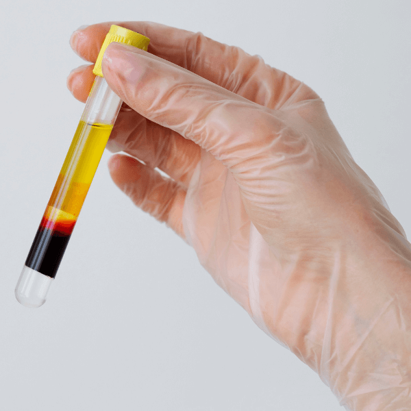Tubo de plasma rico en plaquetas